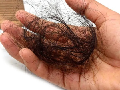 Hormony a wypadanie włosów