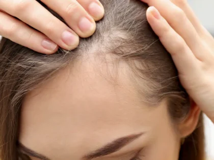 Baby hair – jak je pobudzić i co robić, by rosły dalej?